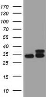 CYB5R3 / B5R Antibody (clone OTI2A10)