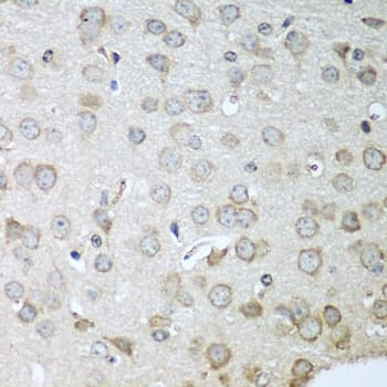 CDH11 / Cadherin 11 Antibody