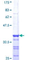 Human BRCA1 Protein (Recombinant GST, N-terminus)