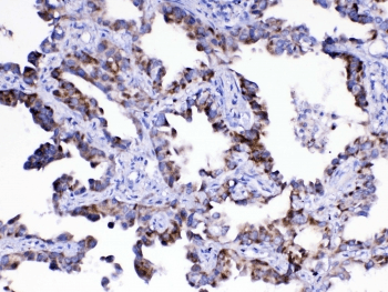 Polyclonal Rabbit anti-Human ASL / Argininosuccinate Lyase Antibody (IHC, WB)