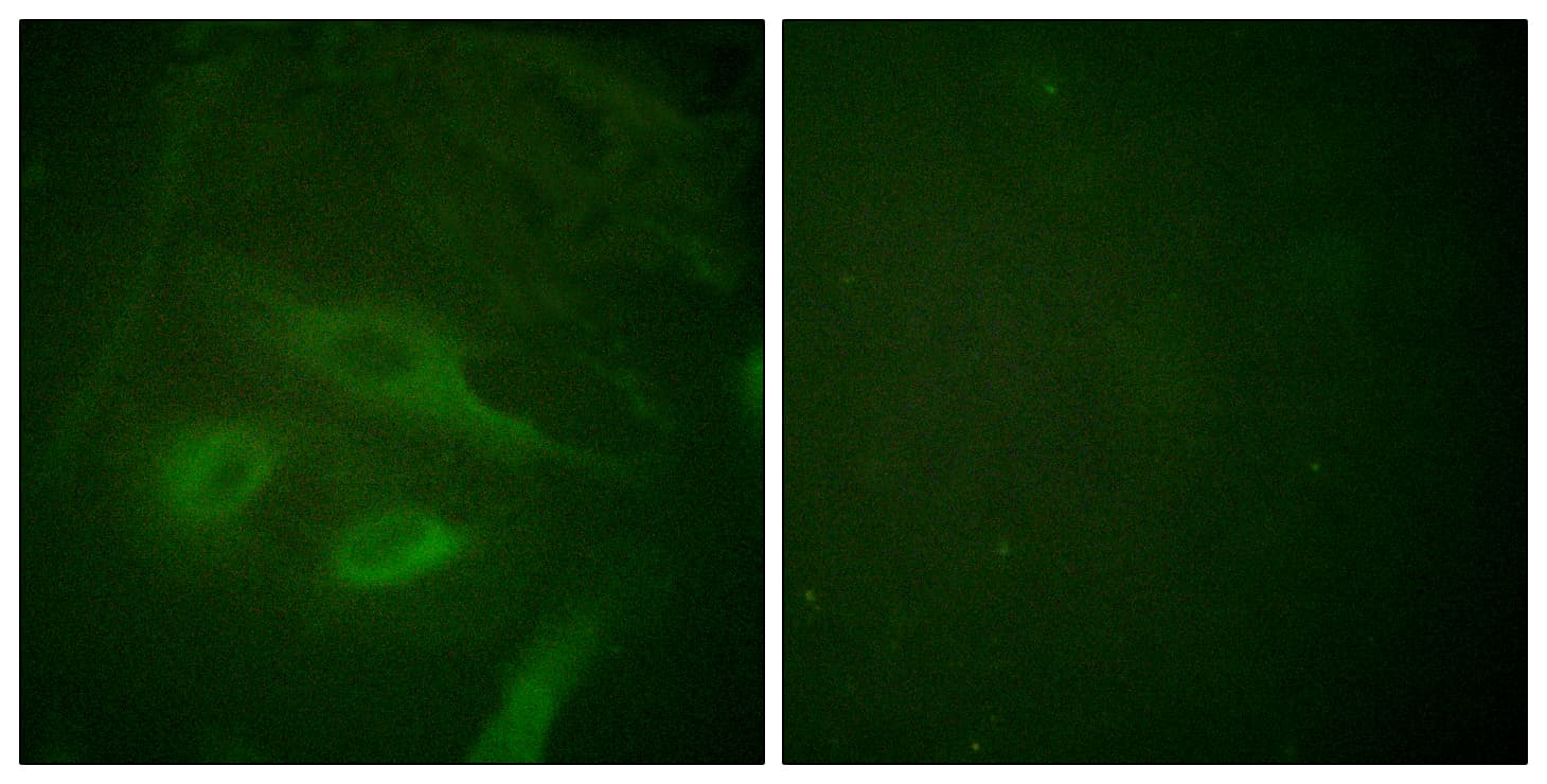 NFKBIE / IKB Epsilon Antibody (aa131-180)