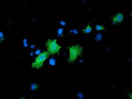 CNDP2 Antibody (clone OTI6D3)