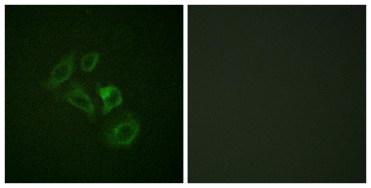 Polyclonal Rabbit anti-Human c-Met Antibody (phospho-Tyr1003, IHC, IF, WB)