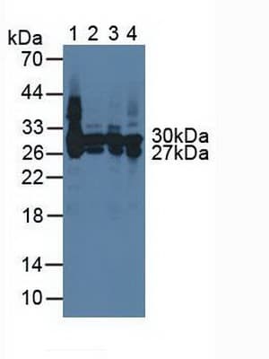 CA2 / Carbonic Anhydrase II Antibody (aa1-260, APC)