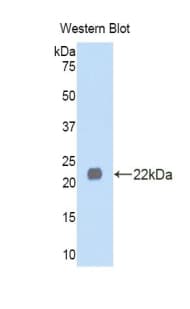 LEFTYB / LEFTY1 Antibody (aa167-332)
