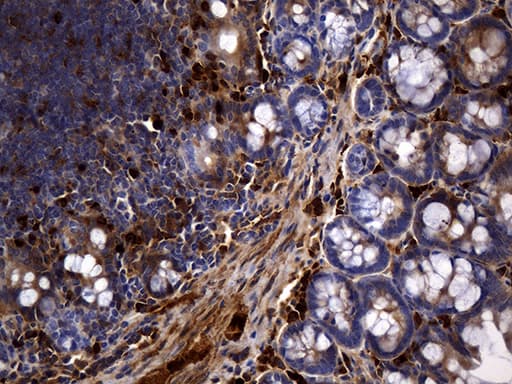 MME / CD10 Antibody (aa411-750, clone UMAB236)