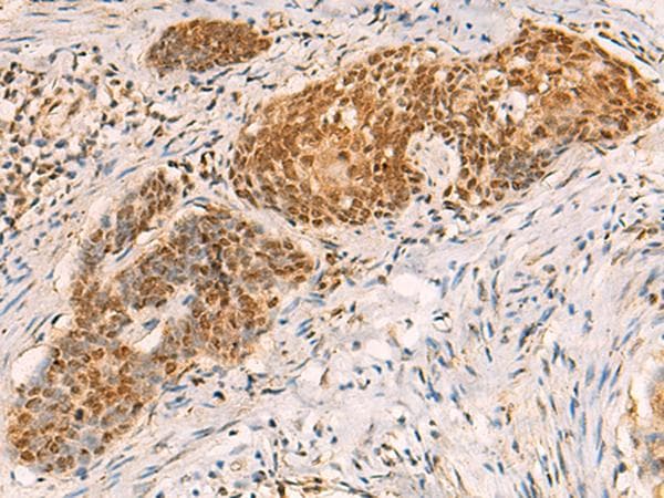 SREBF2 / SREBP2 Antibody