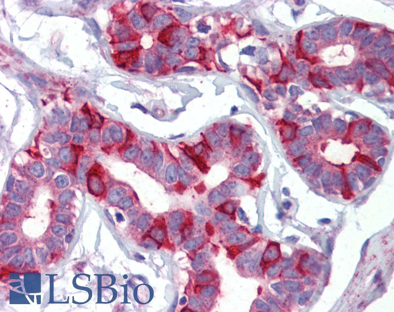 IHC-plus™ Polyclonal Rabbit anti-Human FASN / Fatty Acid Synthase Antibody (aa942-973, IHC, IF, WB)