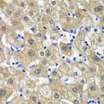 MAT / MAT1A Antibody