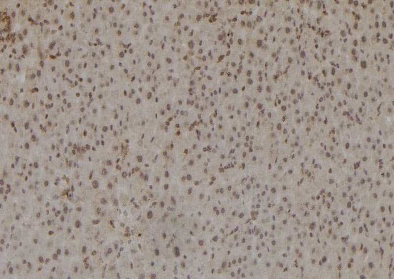 Polyclonal Rabbit anti-Human RB1 / Retinoblastoma / RB Antibody (IHC, IF, WB)