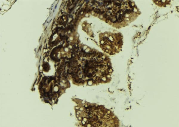 KDM1A / LSD1 Antibody