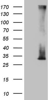 RAB3A Antibody (clone OTI1G4)