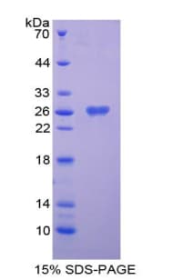 Human NOTCH2 Protein (Recombinant His, N-Terminal)
