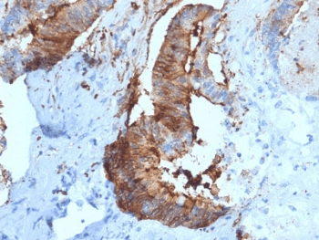 CTSD / Cathepsin D Antibody (clone CTSD/2781)