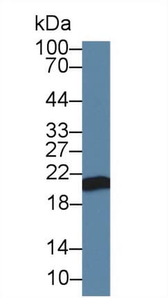 APOM / Apolipoprotein M Antibody (aa23-188)