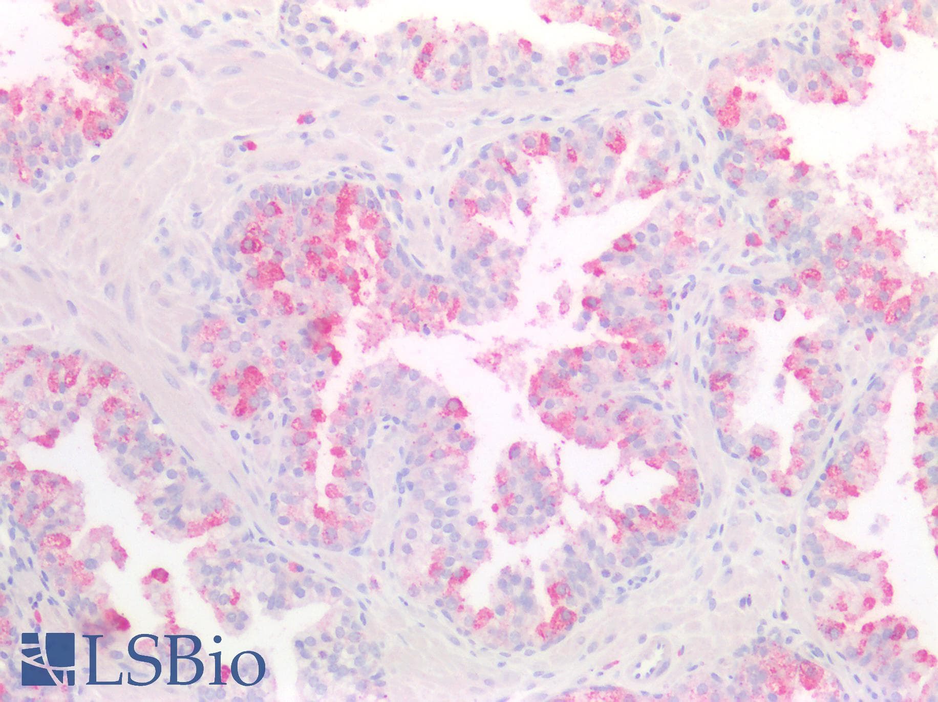 IHC-plus™ Polyclonal Rabbit anti-Human Osteonectin / SPARC Antibody (IHC)