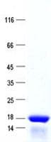 Human C11orf71 Protein (Recombinant His, N-Terminal)