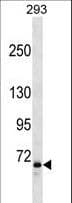 FOXP2 Antibody (aa657-684)