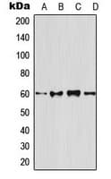 OPG / Osteoprotegerin Antibody (N-Terminus)