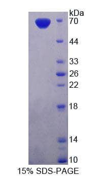 Rat PDE3A Protein (Recombinant His-GST, N-terminus)