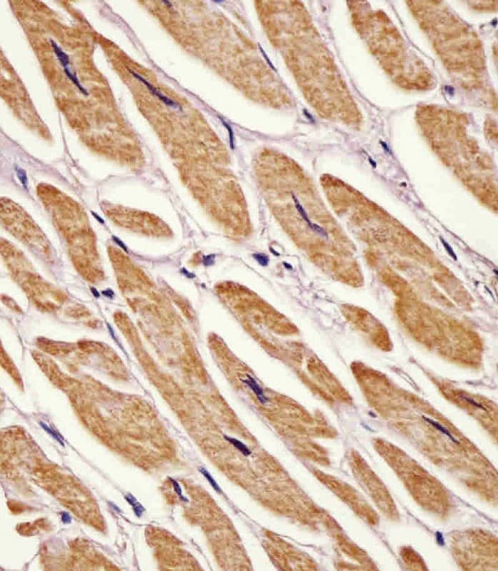 AK2 / Adenylate Kinase 2 Antibody (aa147-183)