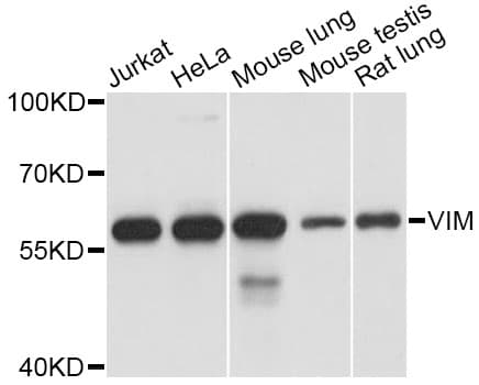 Vimentin Antibody