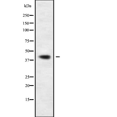 Polyclonal Rabbit anti-Human GMDS / GMD Antibody (WB)