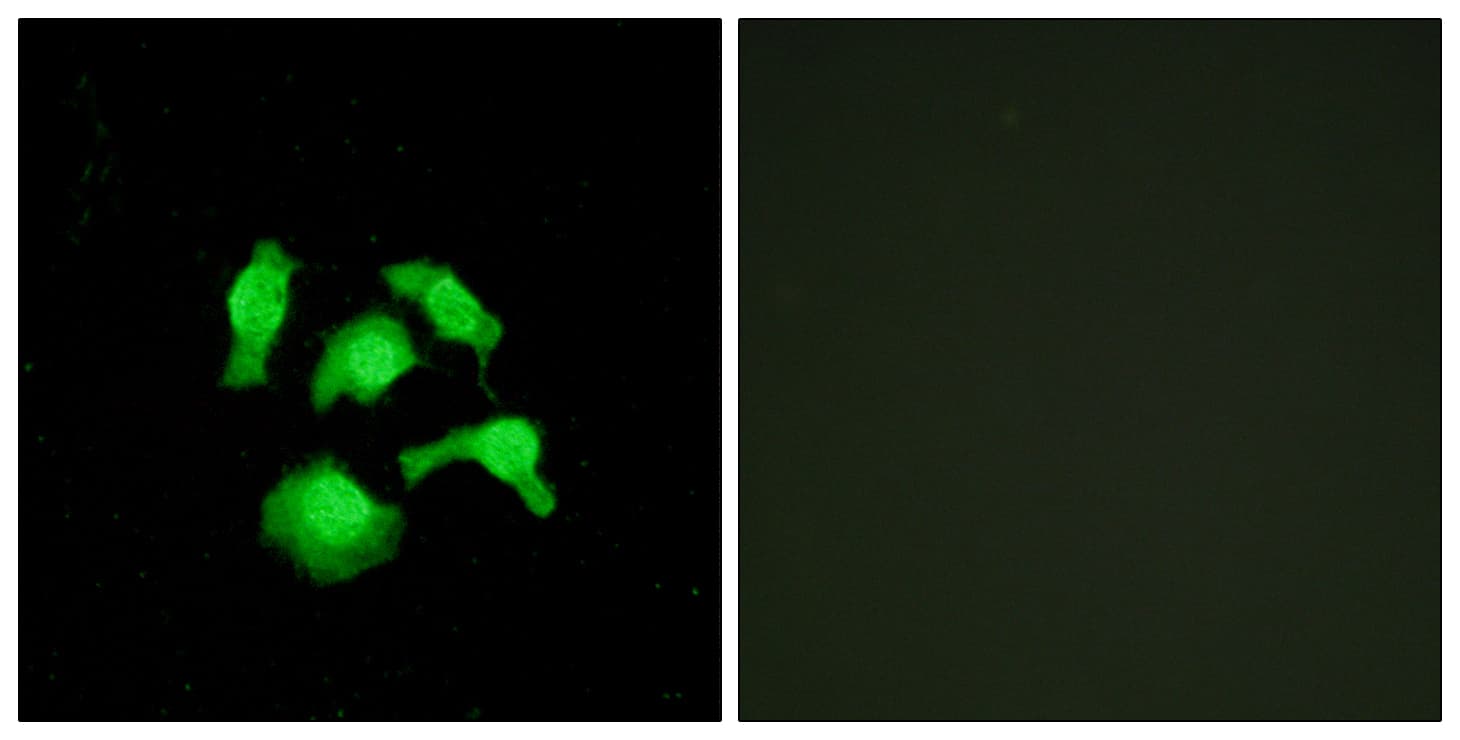 IHC-plus™ Polyclonal Rabbit anti-Human TSC22D1 / TSC22 Antibody (aa1000-1030, IHC, IF, WB)
