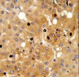 PRKAA1 / AMPK Alpha 1 Antibody