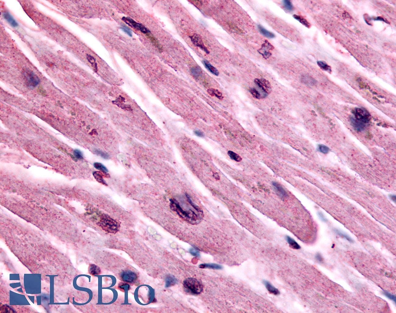 IHC-plus™ Polyclonal Rabbit anti-Human CHRM3 / M3 Antibody (Cytoplasmic Domain, IHC)