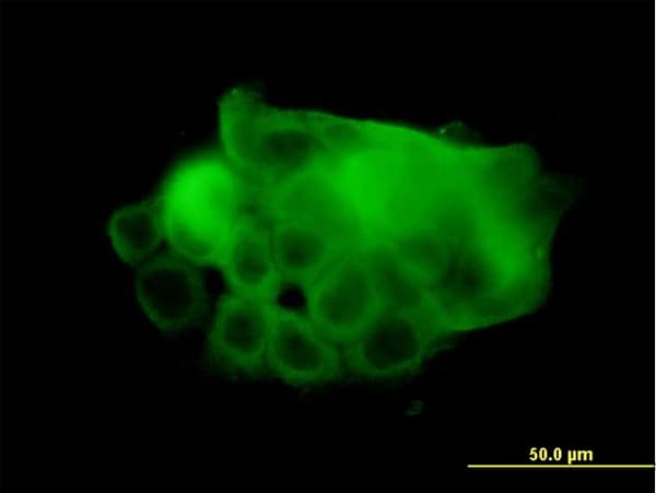 IHC-plus™ Monoclonal Mouse anti-Human ATP2A1 / SERCA1 Antibody (clone 1B11, IHC, IF, WB)