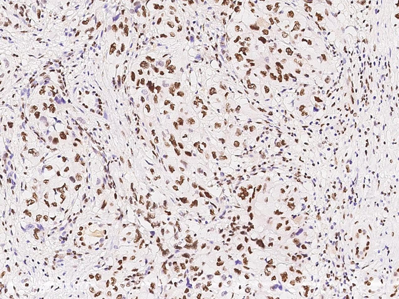 HNF1B / HNF1 Beta Antibody