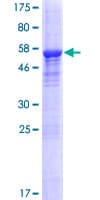 Human SPRYD5 Protein (Recombinant GST)