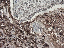 F13A1 / Factor XIIIa Antibody (clone 6F5, Carrier-free)