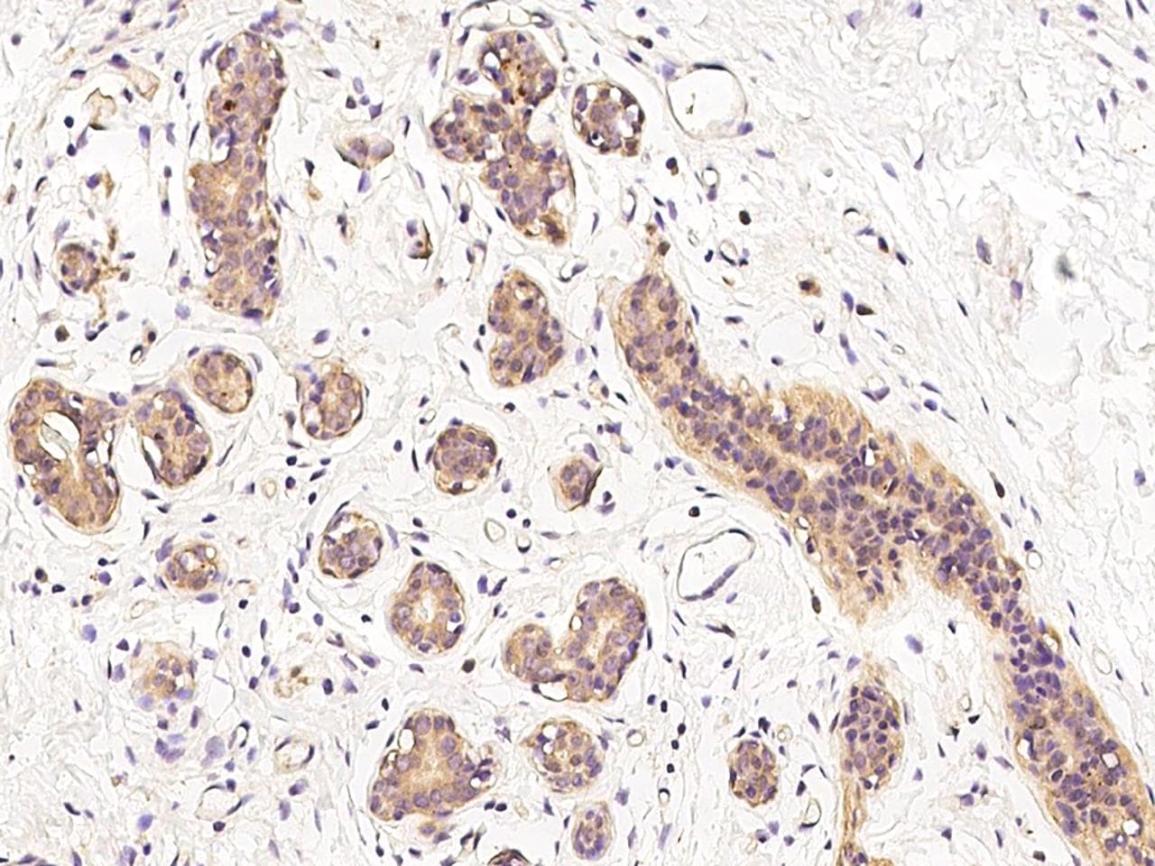MMP15 Antibody