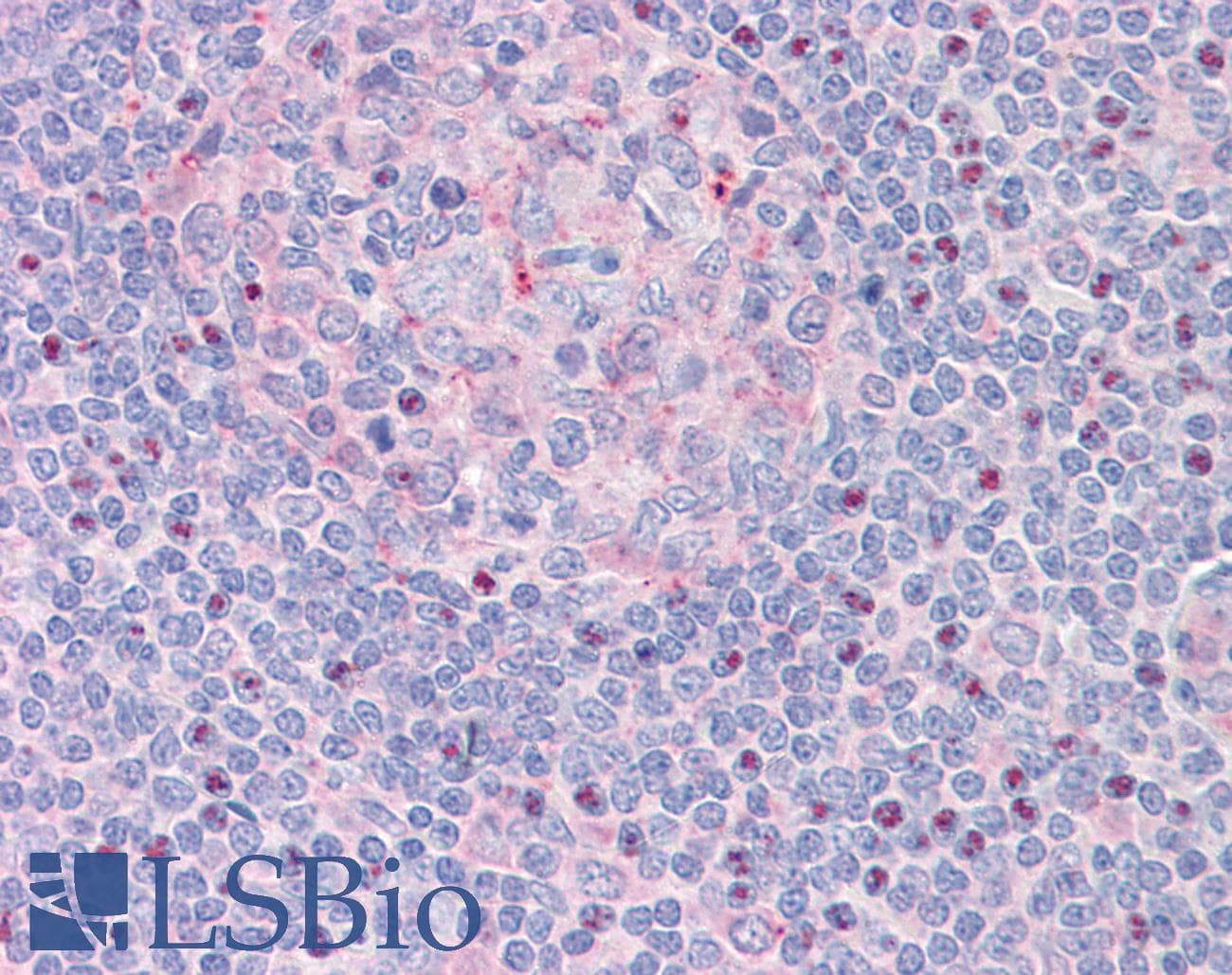 IHC-plus™ CTDSP1 / SCP1 Antibody (aa82-92)