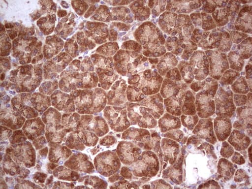 UBE2D2 / UBCH5B Antibody (clone OTI2C2)