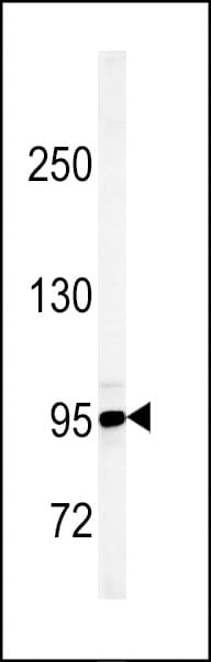 IHC-plus™ Polyclonal Rabbit anti-Human KDM7A / JHDM1D Antibody (aa290-316, IHC, WB)
