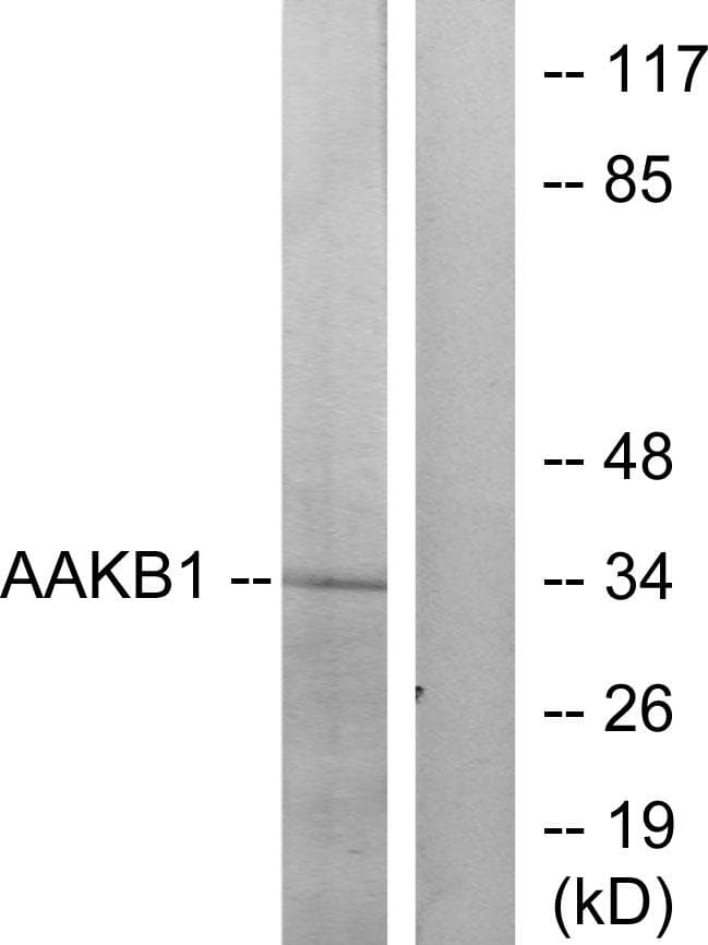 PRKAB1 / AMPK Beta 1 Antibody