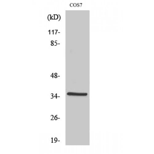 FOXL1 Antibody (90-170 aa, Internal)