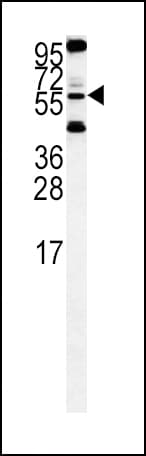 HTRA1 Antibody (aa381-412)