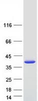 Human SULT1E1 / Sulfotransferase 1E1 Protein (Recombinant Myc-DDK (Flag))