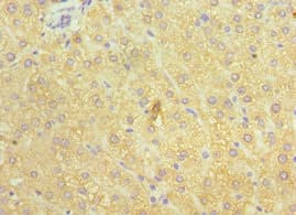 Polyclonal Rabbit anti-Human WC1 / ATP7B Antibody (aa1166-1465, IHC)