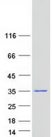 Human CCDC43 Protein (Recombinant Myc-DDK (Flag))