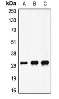 F10 / Factor X Antibody (Internal)