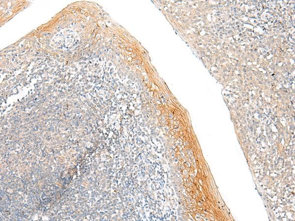 Polyclonal Rabbit anti-Human FAM110D / GRRP1 Antibody (IHC)