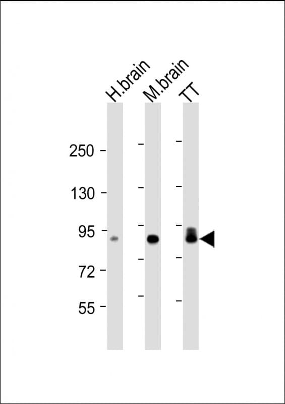 DCLK / DCLK1 Antibody (clone 1751CT665.1.72)