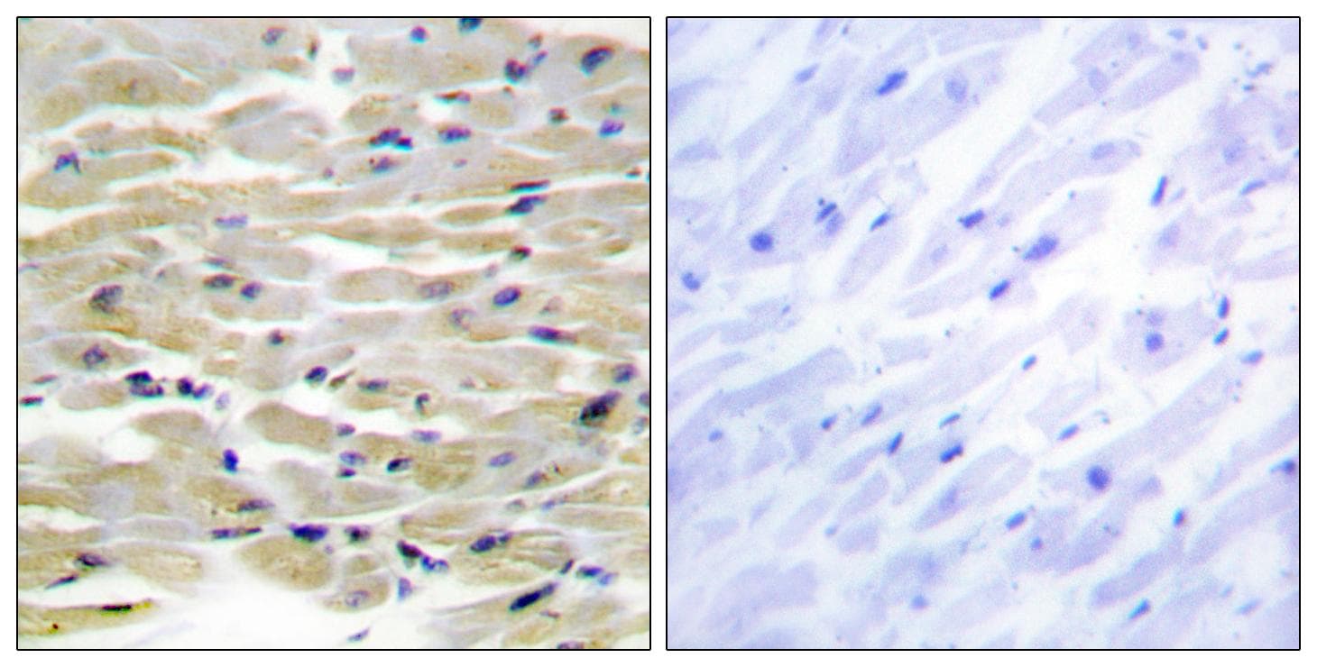 TNS3 / Tensin 3 Antibody