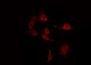 ERBB4 / HER4 Antibody