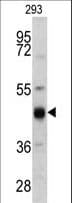 KRT13 / CK13 / Cytokeratin 13 Antibody (aa106-138)